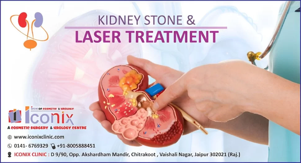 Laser Treatment of Kidney Stone - Dr. Arjun Singh Shekhawat