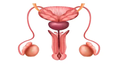 Penile Curvature and Peyronie’s Disease